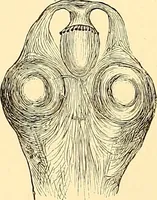 An illustration from Clinical diagnosis : the bacteriological, chemical, and microscopical evidence of disease / by Rudolf v. Jaksch ; tr. from the 3rd German ed. and enlarged by James Cagney ; with numerous illustrations (partly in colours). (1893)