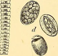 An illustration from Clinical diagnosis : the bacteriological, chemical, and microscopical evidence of disease / by Rudolf v. Jaksch ; tr. from the 3rd German ed. and enlarged by James Cagney ; with numerous illustrations (partly in colours). (1893)