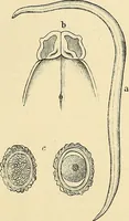An illustration from Clinical diagnosis : the bacteriological, chemical, and microscopical evidence of disease / by Rudolf v. Jaksch ; tr. from the 3rd German ed. and enlarged by James Cagney ; with numerous illustrations (partly in colours). (1893)