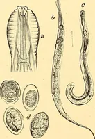 An illustration from Clinical diagnosis : the bacteriological, chemical, and microscopical evidence of disease / by Rudolf v. Jaksch ; tr. from the 3rd German ed. and enlarged by James Cagney ; with numerous illustrations (partly in colours). (1893)