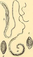 An illustration from Clinical diagnosis : the bacteriological, chemical, and microscopical evidence of disease / by Rudolf v. Jaksch ; tr. from the 3rd German ed. and enlarged by James Cagney ; with numerous illustrations (partly in colours). (1893)