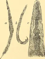 An illustration from Clinical diagnosis : the bacteriological, chemical, and microscopical evidence of disease / by Rudolf v. Jaksch ; tr. from the 3rd German ed. and enlarged by James Cagney ; with numerous illustrations (partly in colours). (1893)