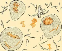 An illustration from Clinical diagnosis : the bacteriological, chemical, and microscopical evidence of disease / by Rudolf v. Jaksch ; tr. from the 3rd German ed. and enlarged by James Cagney ; with numerous illustrations (partly in colours). (1893)