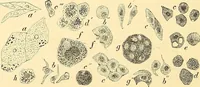 An illustration from Clinical diagnosis : the bacteriological, chemical, and microscopical evidence of disease / by Rudolf v. Jaksch ; tr. from the 3rd German ed. and enlarged by James Cagney ; with numerous illustrations (partly in colours). (1893)