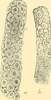 An illustration from Clinical diagnosis : the bacteriological, chemical, and microscopical evidence of disease / by Rudolf v. Jaksch ; tr. from the 3rd German ed. and enlarged by James Cagney ; with numerous illustrations (partly in colours). (1893)