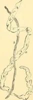 An illustration from Clinical diagnosis : the bacteriological, chemical, and microscopical evidence of disease / by Rudolf v. Jaksch ; tr. from the 3rd German ed. and enlarged by James Cagney ; with numerous illustrations (partly in colours). (1893)
