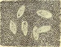 An illustration from Clinical diagnosis : the bacteriological, chemical, and microscopical evidence of disease / by Rudolf v. Jaksch ; tr. from the 3rd German ed. and enlarged by James Cagney ; with numerous illustrations (partly in colours). (1893)