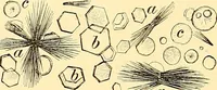 An illustration from Clinical diagnosis : the bacteriological, chemical, and microscopical evidence of disease / by Rudolf v. Jaksch ; tr. from the 3rd German ed. and enlarged by James Cagney ; with numerous illustrations (partly in colours). (1893)
