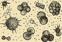 An illustration from Clinical diagnosis : the bacteriological, chemical, and microscopical evidence of disease / by Rudolf v. Jaksch ; tr. from the 3rd German ed. and enlarged by James Cagney ; with numerous illustrations (partly in colours). (1893)