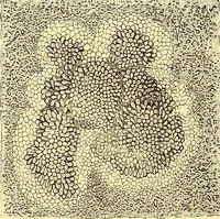An illustration from Clinical diagnosis : the bacteriological, chemical, and microscopical evidence of disease / by Rudolf v. Jaksch ; tr. from the 3rd German ed. and enlarged by James Cagney ; with numerous illustrations (partly in colours). (1893)