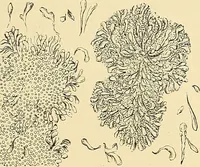 An illustration from Clinical diagnosis : the bacteriological, chemical, and microscopical evidence of disease / by Rudolf v. Jaksch ; tr. from the 3rd German ed. and enlarged by James Cagney ; with numerous illustrations (partly in colours). (1893)