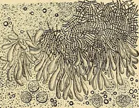 An illustration from Clinical diagnosis : the bacteriological, chemical, and microscopical evidence of disease / by Rudolf v. Jaksch ; tr. from the 3rd German ed. and enlarged by James Cagney ; with numerous illustrations (partly in colours). (1893)