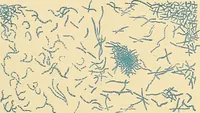An illustration from Clinical diagnosis : the bacteriological, chemical, and microscopical evidence of disease / by Rudolf v. Jaksch ; tr. from the 3rd German ed. and enlarged by James Cagney ; with numerous illustrations (partly in colours). (1893)