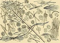 An illustration from Clinical diagnosis : the bacteriological, chemical, and microscopical evidence of disease / by Rudolf v. Jaksch ; tr. from the 3rd German ed. and enlarged by James Cagney ; with numerous illustrations (partly in colours). (1893)