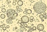 An illustration from Clinical diagnosis : the bacteriological, chemical, and microscopical evidence of disease / by Rudolf v. Jaksch ; tr. from the 3rd German ed. and enlarged by James Cagney ; with numerous illustrations (partly in colours). (1893)