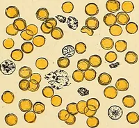 Picture 8 of 74 from Clinical diagnosis : the bacteriological, chemical, and microscopical evidence of disease / by Rudolf v. Jaksch ; tr. from the 3rd German ed. and enlarged by James Cagney ; with numerous illustrations (partly in colours). (1893), leaf 63