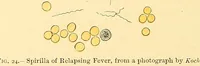 Picture 9 of 74 from Clinical diagnosis : the bacteriological, chemical, and microscopical evidence of disease / by Rudolf v. Jaksch ; tr. from the 3rd German ed. and enlarged by James Cagney ; with numerous illustrations (partly in colours). (1893), leaf 72