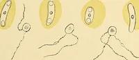 An illustration from Clinical diagnosis : the bacteriological, chemical, and microscopical evidence of disease / by Rudolf v. Jaksch ; tr. from the 3rd German ed. and enlarged by James Cagney ; with numerous illustrations (partly in colours). (1893)