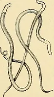 An illustration from Clinical diagnosis : the bacteriological, chemical, and microscopical evidence of disease / by Rudolf v. Jaksch ; tr. from the 3rd German ed. and enlarged by James Cagney ; with numerous illustrations (partly in colours). (1893)