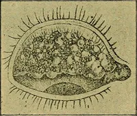 An illustration from Diseases of the eye / by Edward Nettleship ; with a supplement on examinations for color-blindness and acuity of vision and hearing, by William Thomson ; with 5 colored plates and 192 engravings. (1900)
