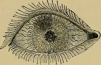 An illustration from Diseases of the eye / by Edward Nettleship ; with a supplement on examinations for color-blindness and acuity of vision and hearing, by William Thomson ; with 5 colored plates and 192 engravings. (1900)