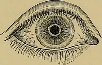 An illustration from Diseases of the eye / by Edward Nettleship ; with a supplement on examinations for color-blindness and acuity of vision and hearing, by William Thomson ; with 5 colored plates and 192 engravings. (1900)
