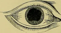An illustration from Diseases of the eye / by Edward Nettleship ; with a supplement on examinations for color-blindness and acuity of vision and hearing, by William Thomson ; with 5 colored plates and 192 engravings. (1900)