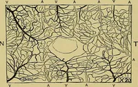 An illustration from Diseases of the eye / by Edward Nettleship ; with a supplement on examinations for color-blindness and acuity of vision and hearing, by William Thomson ; with 5 colored plates and 192 engravings. (1900)