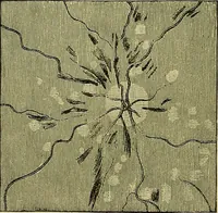 An illustration from Diseases of the eye / by Edward Nettleship ; with a supplement on examinations for color-blindness and acuity of vision and hearing, by William Thomson ; with 5 colored plates and 192 engravings. (1900)