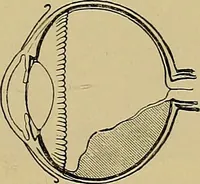 An illustration from Diseases of the eye / by Edward Nettleship ; with a supplement on examinations for color-blindness and acuity of vision and hearing, by William Thomson ; with 5 colored plates and 192 engravings. (1900)