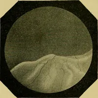 An illustration from Diseases of the eye / by Edward Nettleship ; with a supplement on examinations for color-blindness and acuity of vision and hearing, by William Thomson ; with 5 colored plates and 192 engravings. (1900)