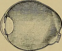 An illustration from Diseases of the eye / by Edward Nettleship ; with a supplement on examinations for color-blindness and acuity of vision and hearing, by William Thomson ; with 5 colored plates and 192 engravings. (1900)