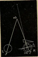 An illustration from Diseases of the eye / by Edward Nettleship ; with a supplement on examinations for color-blindness and acuity of vision and hearing, by William Thomson ; with 5 colored plates and 192 engravings. (1900)