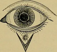 An illustration from Diseases of the eye / by Edward Nettleship ; with a supplement on examinations for color-blindness and acuity of vision and hearing, by William Thomson ; with 5 colored plates and 192 engravings. (1900)