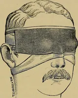 An illustration from Diseases of the eye / by Edward Nettleship ; with a supplement on examinations for color-blindness and acuity of vision and hearing, by William Thomson ; with 5 colored plates and 192 engravings. (1900)