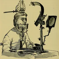 An illustration from Diseases of the eye / by Edward Nettleship ; with a supplement on examinations for color-blindness and acuity of vision and hearing, by William Thomson ; with 5 colored plates and 192 engravings. (1900)