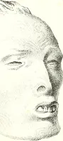 An illustration from Grundzüge der Phrenologie, oder, Anleitung zum Studium dieser Wissenschaft : mit Berücksichtigung der neueren Forschungen auf dem Gebiete der Physiologie und Psychologie / von R.R. Noel. (1847)