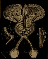An illustration from Des altérations de l'oeil dans l'albuminurie et le diabète / par Mohammed Off ; avec planches en chromolithographie. (1870)