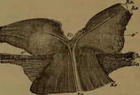 An illustration from Des altérations de l'oeil dans l'albuminurie et le diabète / par Mohammed Off ; avec planches en chromolithographie. (1870)