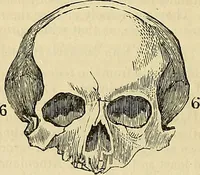 An illustration from The principles of phrenology / by Sidney Smith. (1838)
