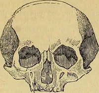 An illustration from The principles of phrenology / by Sidney Smith. (1838)