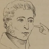 An illustration from Outlines of a new system of physiognomy : illustrated by numerous engravings indicating the location of the signs of the different mental faculties / by J.W. Redfield. (1849)