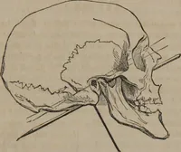 Picture 13 of 23 from The twelve qualities of mind, or, Outlines of a new system of physiognomy, no. II / by J.W. Redfield. (1850), leaf 31