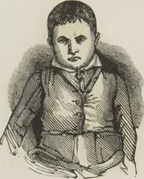 An illustration from Rationale of crime, and its appropriate treatment : being a treatise on criminal jurisprudence considered in relation to cerebral organization / by M.B. Sampson ; with notes and illustrations by E.W. Farnham. (1846)