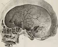 An illustration from An examination of phrenology : in two lectures : delivered to the students of the Columbian College, District of Columbia, February, 1837 / by Thomas Sewall. (1837)