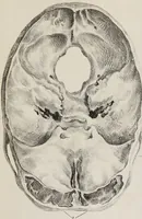 An illustration from An examination of phrenology : in two lectures : delivered to the students of the Columbian College, District of Columbia, February, 1837 / by Thomas Sewall. (1837)