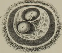 An illustration from Obstetric tables : comprising graphic illustrations, with descriptions and practical remarks : exhibiting on dissected plates many important subjects in midwifery / by G. Spratt. (1848)
