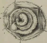 An illustration from Obstetric tables : comprising graphic illustrations, with descriptions and practical remarks : exhibiting on dissected plates many important subjects in midwifery / by G. Spratt. (1848)