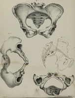 An illustration from Obstetric tables : comprising graphic illustrations, with descriptions and practical remarks : exhibiting on dissected plates many important subjects in midwifery / by G. Spratt. (1848)