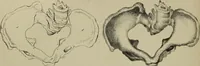 An illustration from Obstetric tables : comprising graphic illustrations, with descriptions and practical remarks : exhibiting on dissected plates many important subjects in midwifery / by G. Spratt. (1848)